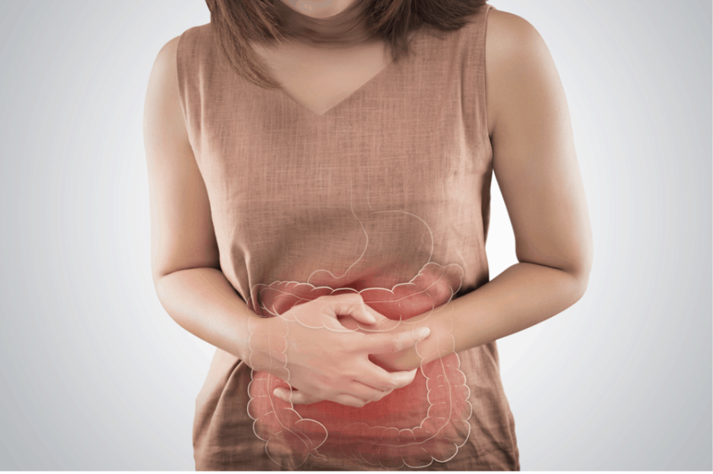 Irritable Bowel Syndrome (IBS)